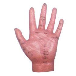 Hand Acupuncture Model