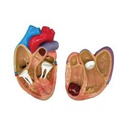 Heart Diseases Model