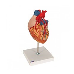 Heart With Bypass Model