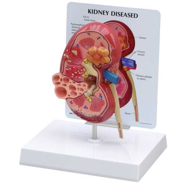 Human Pathology Models