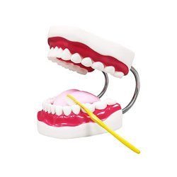 Human Teeth Model - Dental Problems