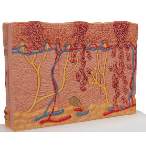 Skin Cancer Model